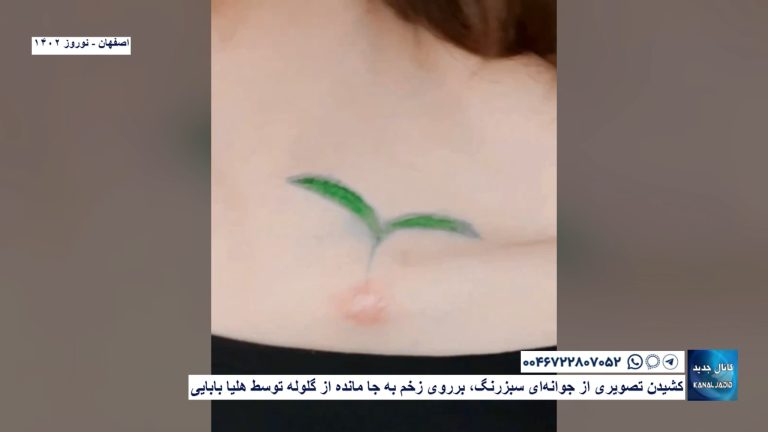 اصفهان – کشیدن تصویری از جوانه‌ای سبزرنگ، بر روی زخم به جا مانده از گلوله‌ توسط هلیا بابایی‌