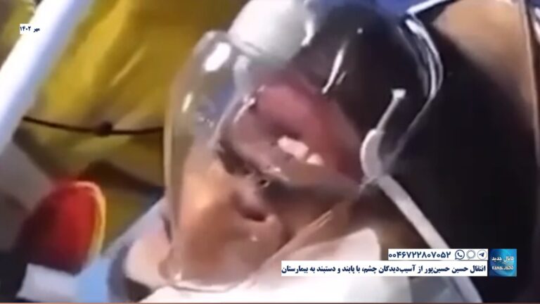 انتقال حسین حسین‌پور از آسیب‌دیدگان چشم، با پابند و دستبند به بیمارستان