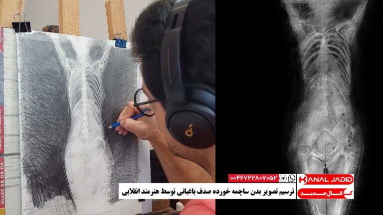 ترسیم تصویر بدن ساچمه خورده صدف باغبانی توسط هنرمند انقلابی